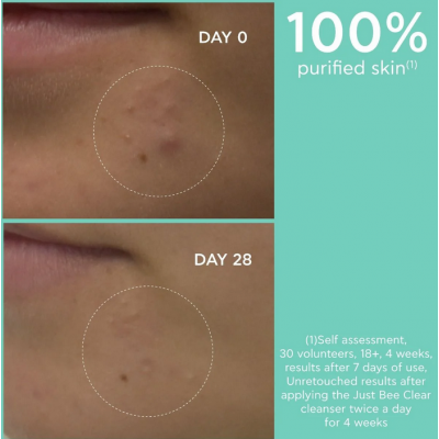 Comprar APIVITA JUST BEE CLEAR GEL LIMPIADOR PURIFICANTE 200 ML al mejor precio en NuestraFarma, tu farmacia online