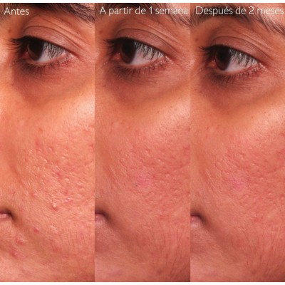 Comprar CAUDALIE VINOPURE SÉRUM CON ACIDO SALICÍLICO ANTI-IMPERFECCIONES 30 ML al mejor precio en NuestraFarma, tu farmacia online