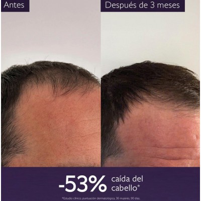 Comprar CAUDALIE SÉRUM CAPILAR ANTICAÍDA 50 ML al mejor precio en NuestraFarma, tu farmacia online